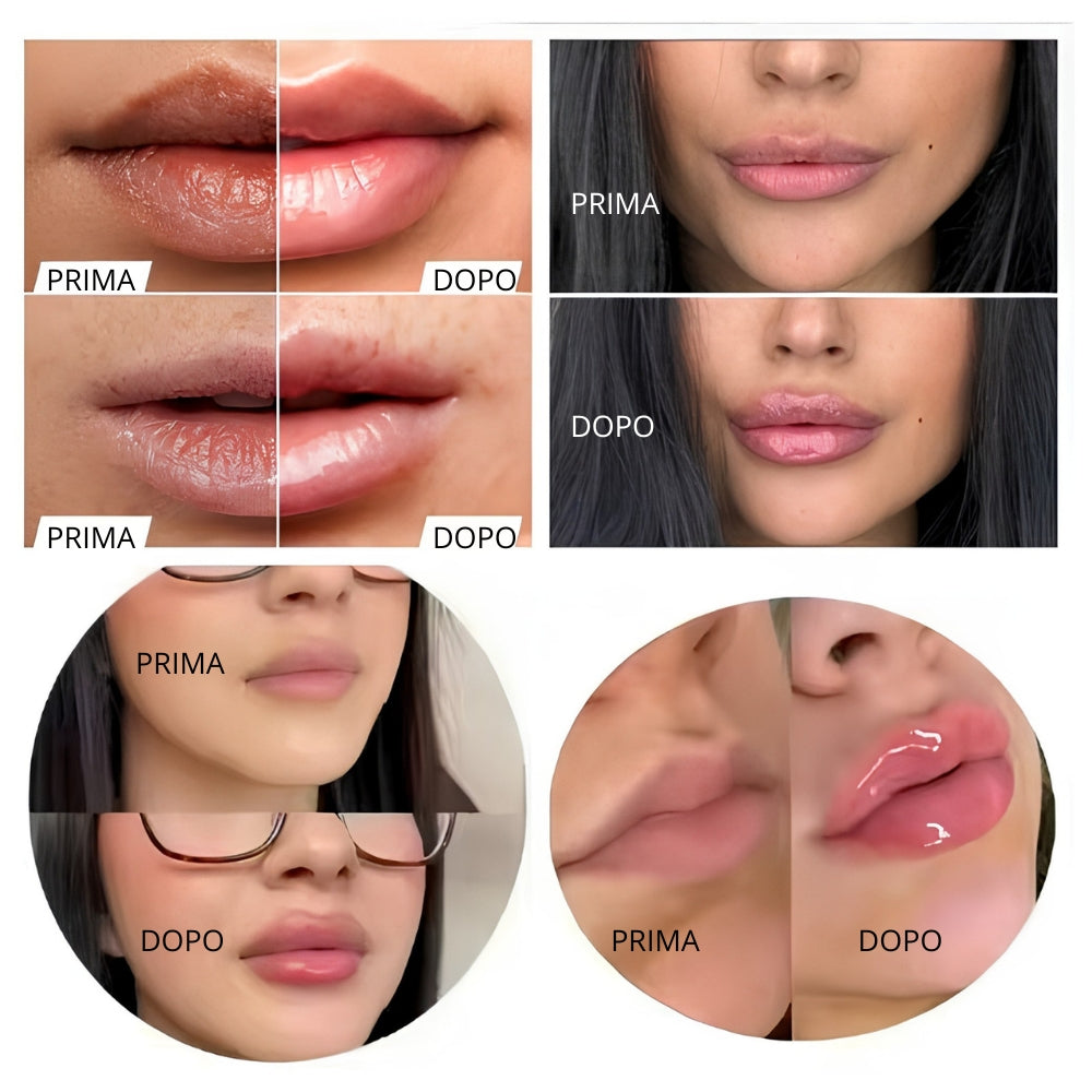 Lip Plumper ™️- Siero volumizzante labbra